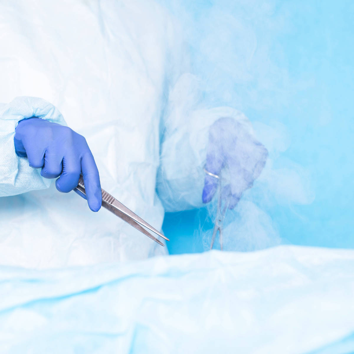 Dr. cryosurgeon performs a modern operation using liquid nitrogen